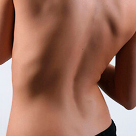 Услуга депиляции поясницы